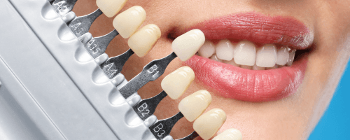 Cosmetic Dentistry Prep