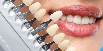 Cosmetic Dentistry Prep